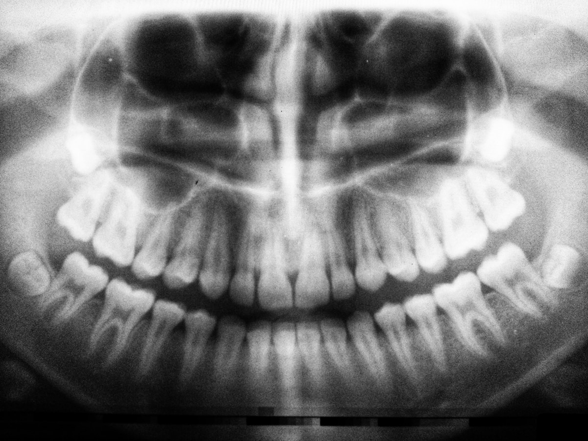 Choosing a dentist in Tenerife as an expat: what actually changes coming from the NHS or AOK